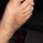 מאיר פיינגולד – דיקור סיני וטיפולי קוסמטיקה במודיעין - תמונה 1