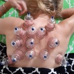 מאיר פיינגולד – דיקור סיני וטיפולי קוסמטיקה במודיעין - תמונה 2