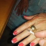 מאיר פיינגולד – דיקור סיני וטיפולי קוסמטיקה במודיעין - תמונה 3