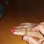 מאיר פיינגולד – דיקור סיני וטיפולי קוסמטיקה במודיעין - תמונה 4