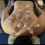 אוראן הלוי - המרכז לטיפול במיגרנות ובכאבים כרוניים ברפואה סינית - תמונה 7