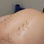 אפי פישר - רפואה סינית בראשון לציון - תמונה 11