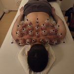 אפי פישר - רפואה סינית בראשון לציון - תמונה 12