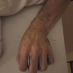 אפי פישר - רפואה סינית בראשון לציון - תמונה 8