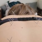 אפי פישר - רפואה סינית בראשון לציון - תמונה 9